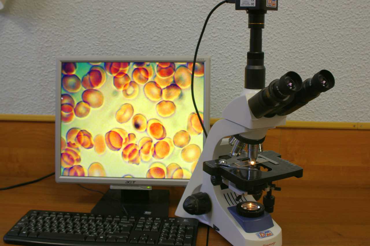 Цифровой микроскоп.